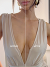 Gatherall Breast Tape before and after